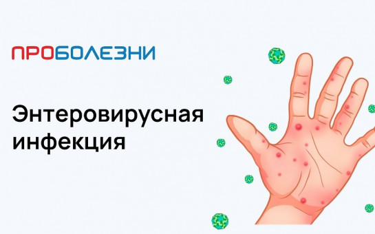 Энтеровирусная инфекция